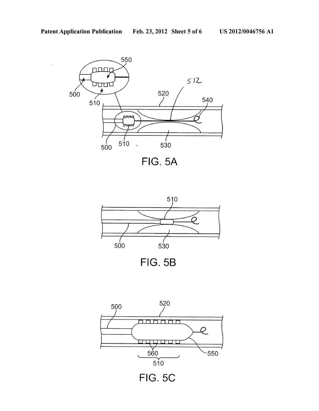 TREATMENT OF NASAL CAVITIES WITH STENT HAVING A SOFT OUTER LAYER - diagram, schematic, and image 06