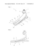 FOOT PROSTHESIS diagram and image