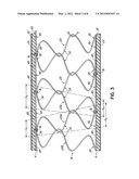 Spring Assembly Having Continuous Bands of Springs diagram and image