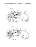 Pocket Safety Cutter diagram and image