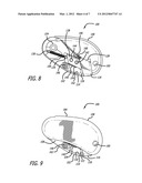 Pocket Safety Cutter diagram and image