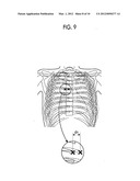 STEREOSCOPIC IMAGE DISPLAYING METHOD AND DEVICE diagram and image