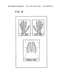 Radiographic image capturing system and radiographic image capturing     method diagram and image