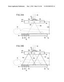 Radiographic image capturing system and radiographic image capturing     method diagram and image