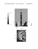 SYSTEM AND METHOD FOR ANALYZING AND VISUALIZING LOCAL CLINICAL FEATURES diagram and image