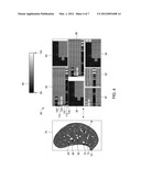 SYSTEM AND METHOD FOR ANALYZING AND VISUALIZING LOCAL CLINICAL FEATURES diagram and image