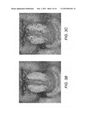 SYSTEMS AND METHODS FOR REVERSIBLE, INCREMENTAL IMAGE SHREDDING diagram and image