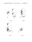 STETHOSCOPE DISINFECTION DEVICE diagram and image