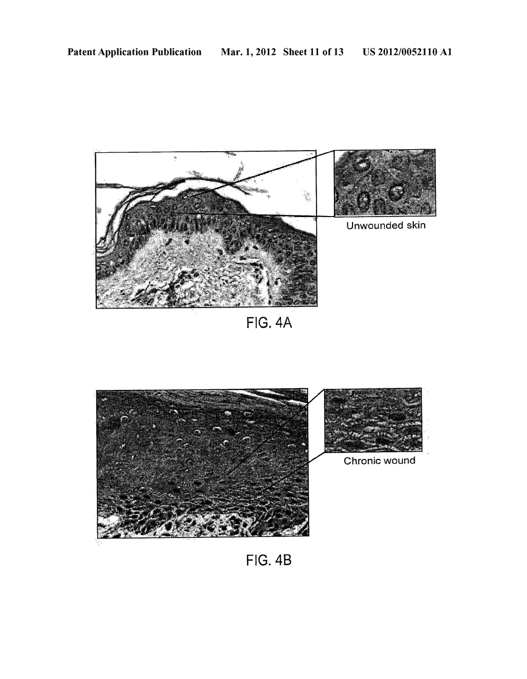 METHODS AND COMPOSITIONS FOR PROMOTING WOUND HEALING - diagram, schematic, and image 12