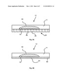 Adhesive Laminates for Rapid Wound Occlusion diagram and image