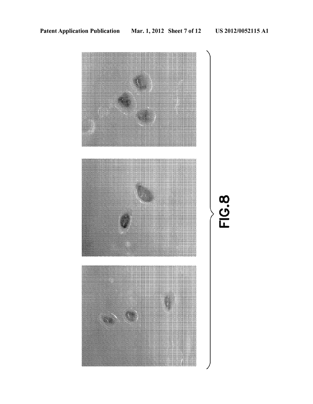 NANOCARRIER THERAPY FOR TREATING INVASIVE TUMORS - diagram, schematic, and image 08