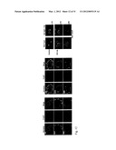 THERAPEUTIC METHOD FOR INCREASING PANCREATIC BETA CELL MASS diagram and image