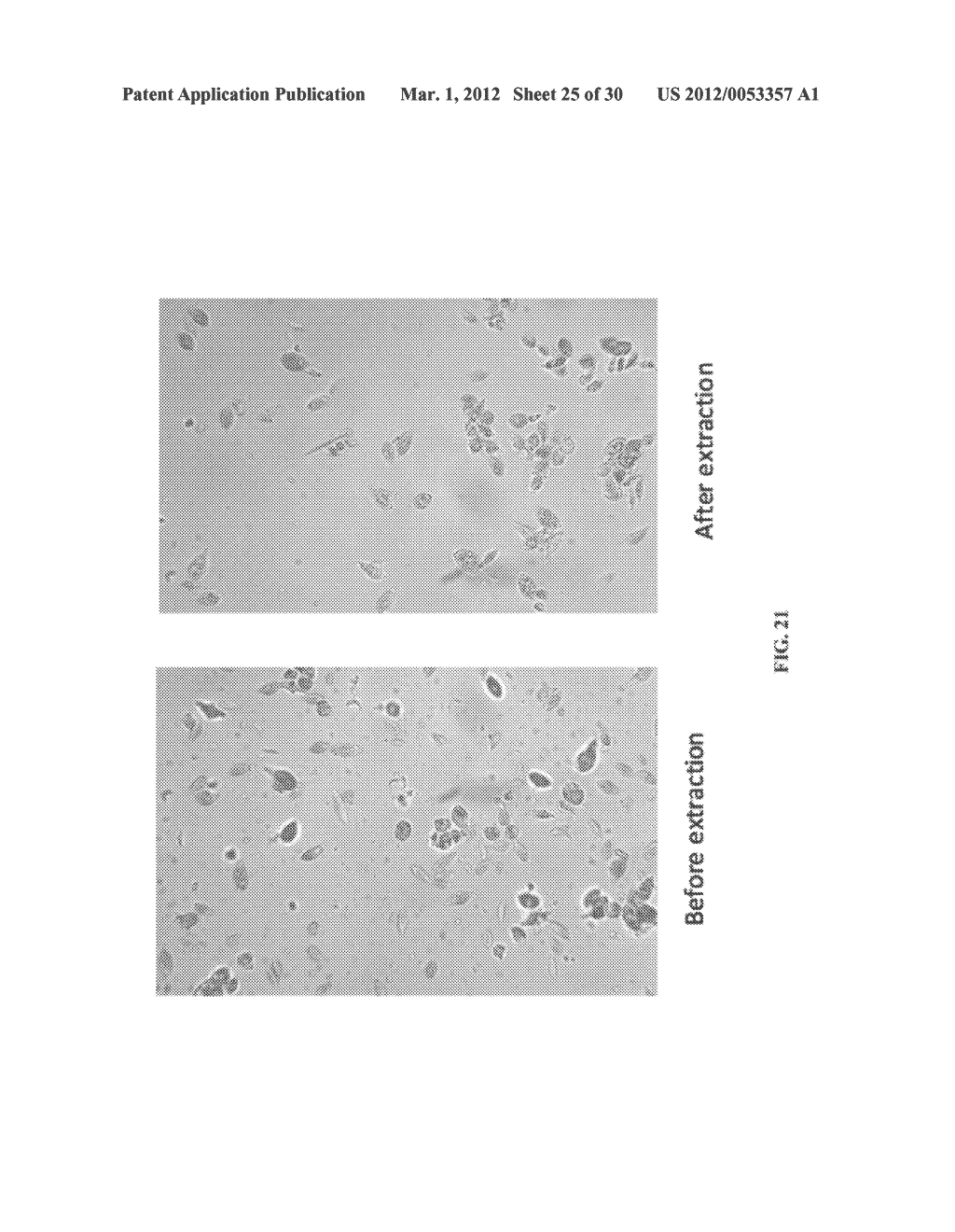 EXTRACTION OF POLAR LIPIDS BY A TWO SOLVENT METHOD - diagram, schematic, and image 26