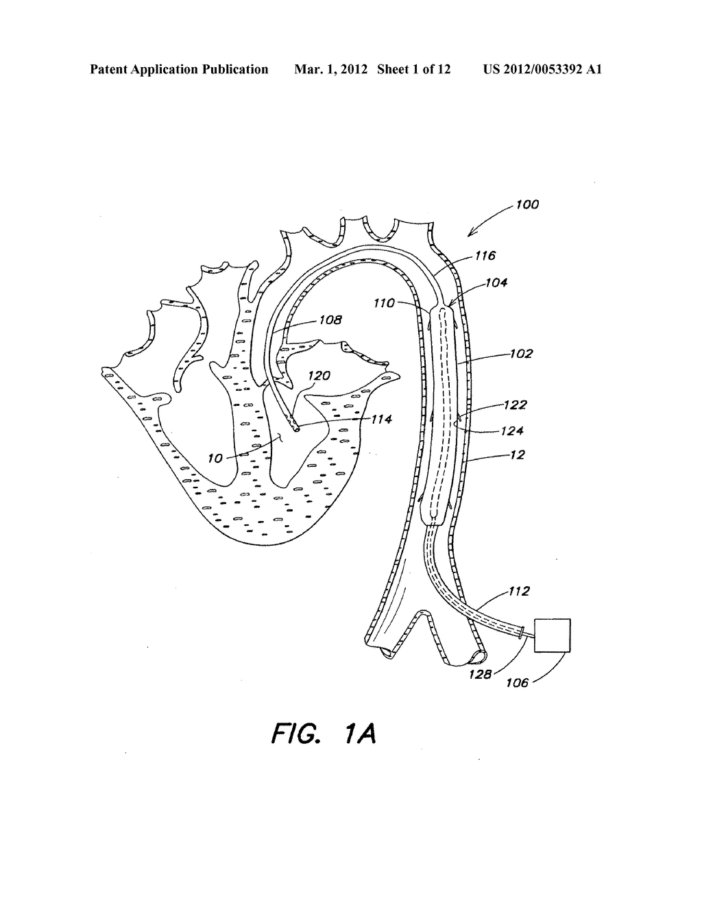 METHOD AND APPARATUS FOR PUMPING BLOOD - diagram, schematic, and image 02