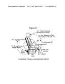 Apparatus and Methods to improve sleep, reduce pain and promote natural     healing diagram and image