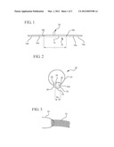 CENTERING AID FOR IMPLANTABLE SLING diagram and image