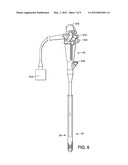 Ablation Overtube diagram and image