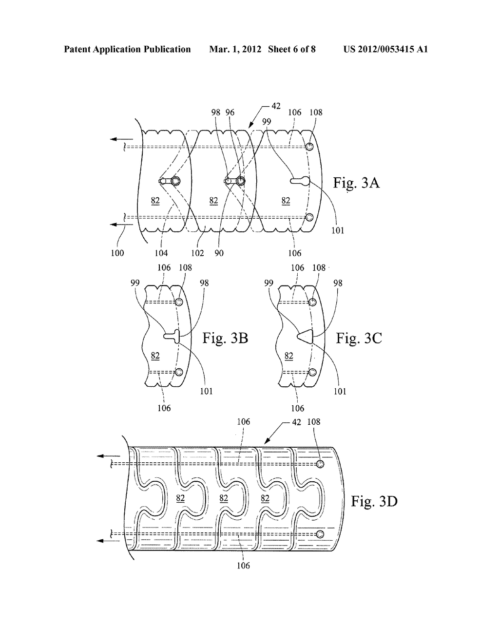 ACCESS SHEATH WITH ACTIVE DEFLECTION - diagram, schematic, and image 07