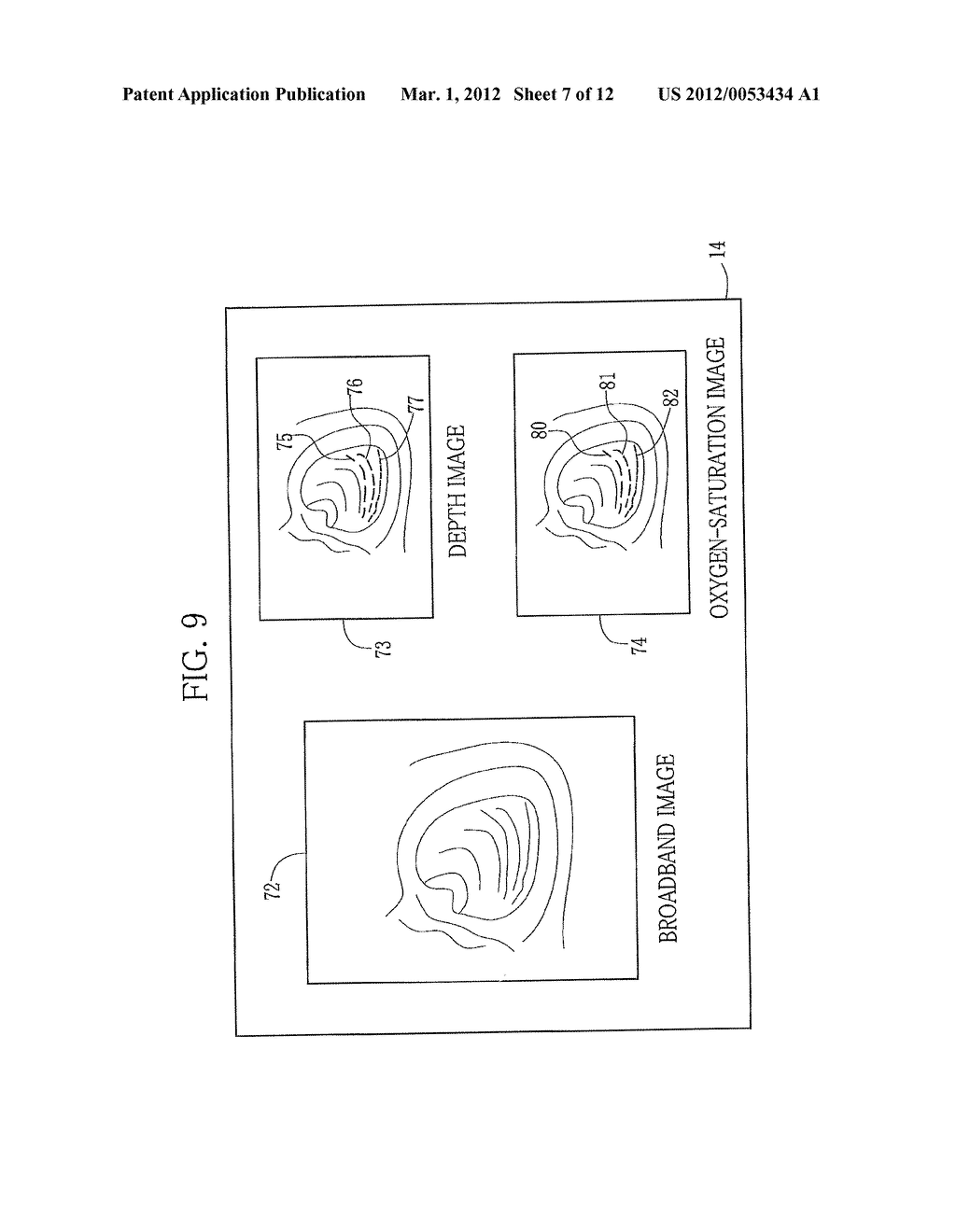 ELECTRONIC ENDOSCOPE SYSTEM AND METHOD FOR OBTAINING VASCULAR INFORMATION - diagram, schematic, and image 08