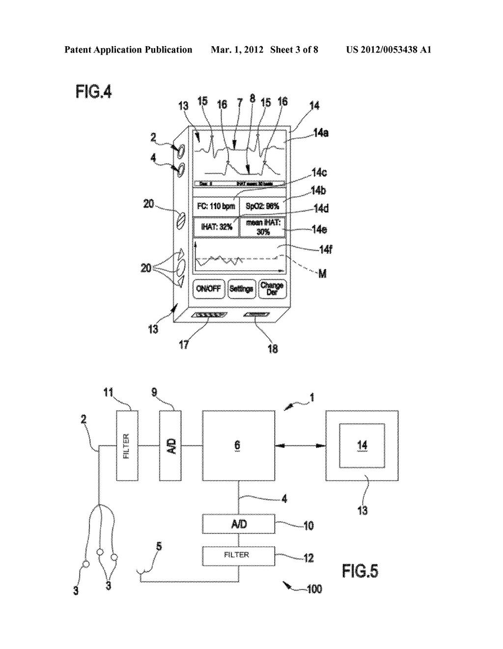 Process and a Device for Determining Conditions of Hypovolemia - diagram, schematic, and image 04