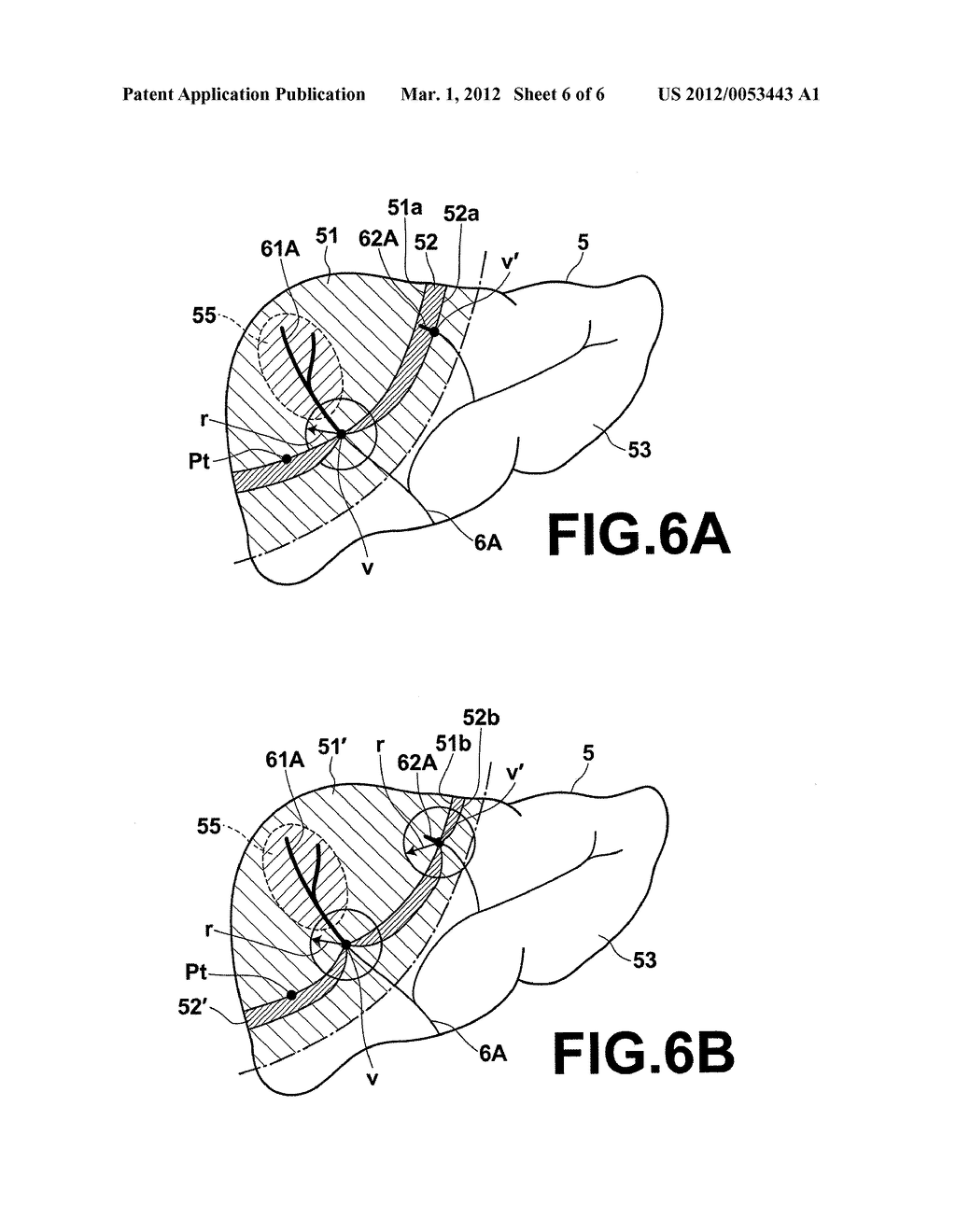 SURGERY-ASSISTANCE APPARATUS AND METHOD, AND COMPUTER-READABLE RECORDING     MEDIUM STORING PROGRAM - diagram, schematic, and image 07