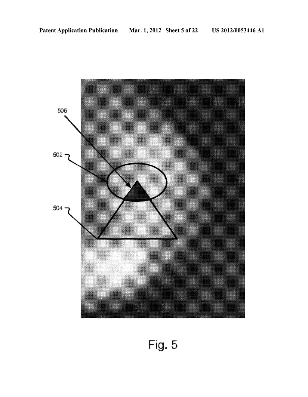 VOTING IN IMAGE PROCESSING - diagram, schematic, and image 06