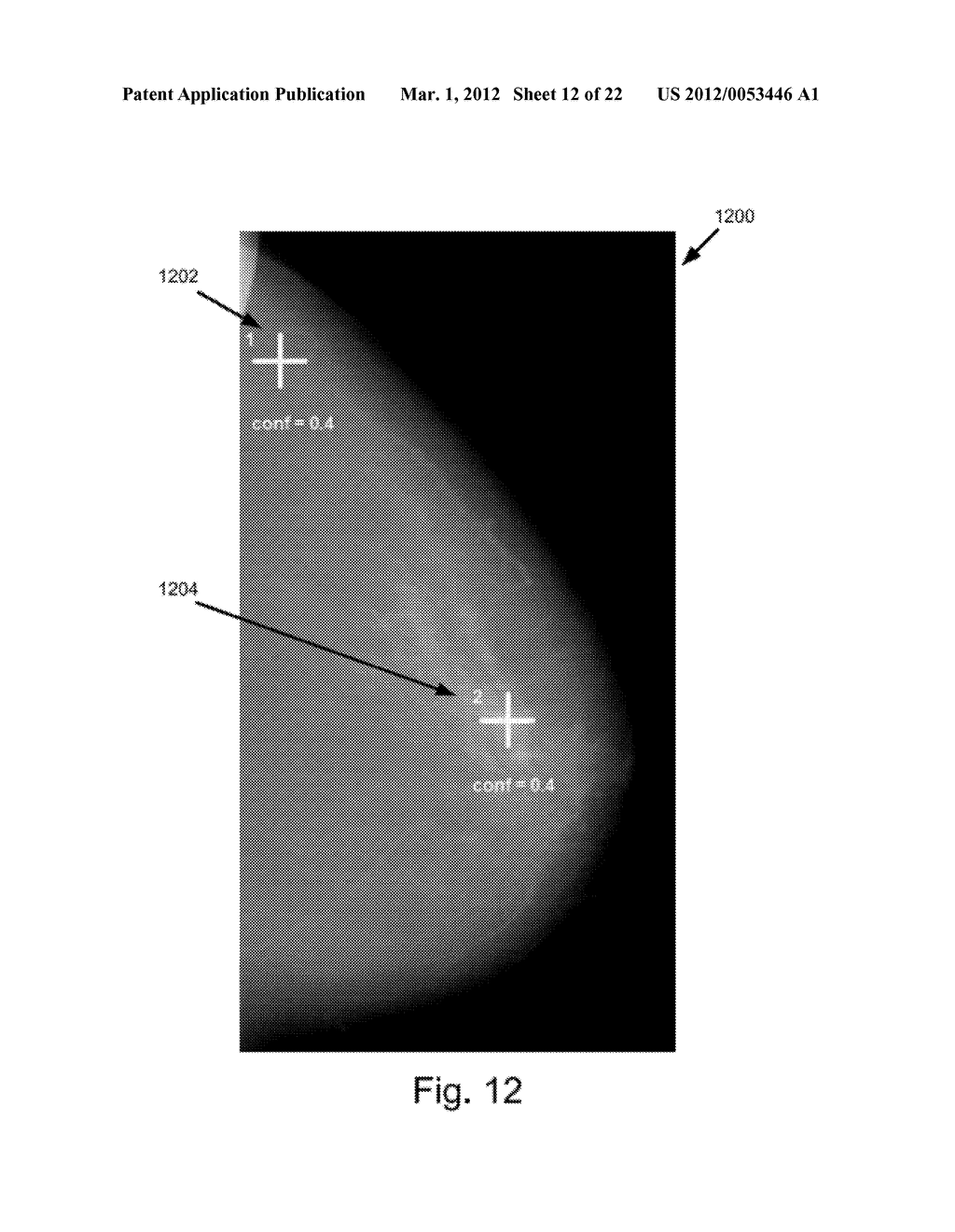 VOTING IN IMAGE PROCESSING - diagram, schematic, and image 13