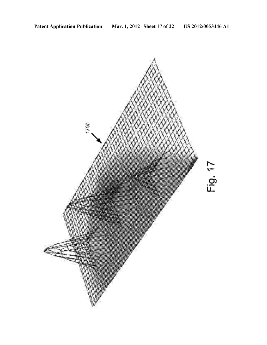 VOTING IN IMAGE PROCESSING - diagram, schematic, and image 18