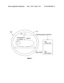 INTERVENTION-INDEPENDENT SCAN PLANE CONTROL FOR MRI diagram and image