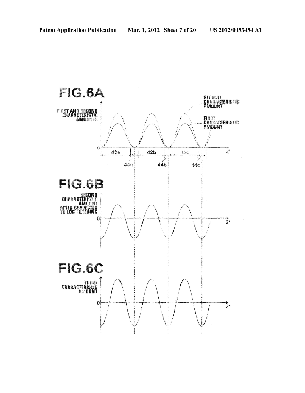 MEDICAL IMAGE ALIGNMENT APPARATUS, METHOD, AND PROGRAM - diagram, schematic, and image 08