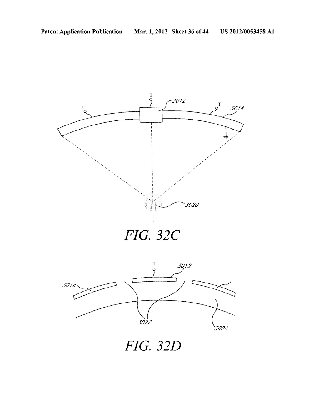 Methods For Non-Invasive Lifting And Tightening Of The Lower Face And Neck - diagram, schematic, and image 37