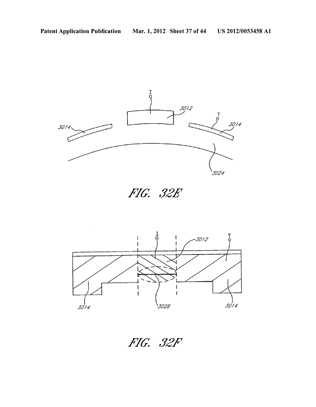 Methods For Non-Invasive Lifting And Tightening Of The Lower Face And Neck - diagram, schematic, and image 38