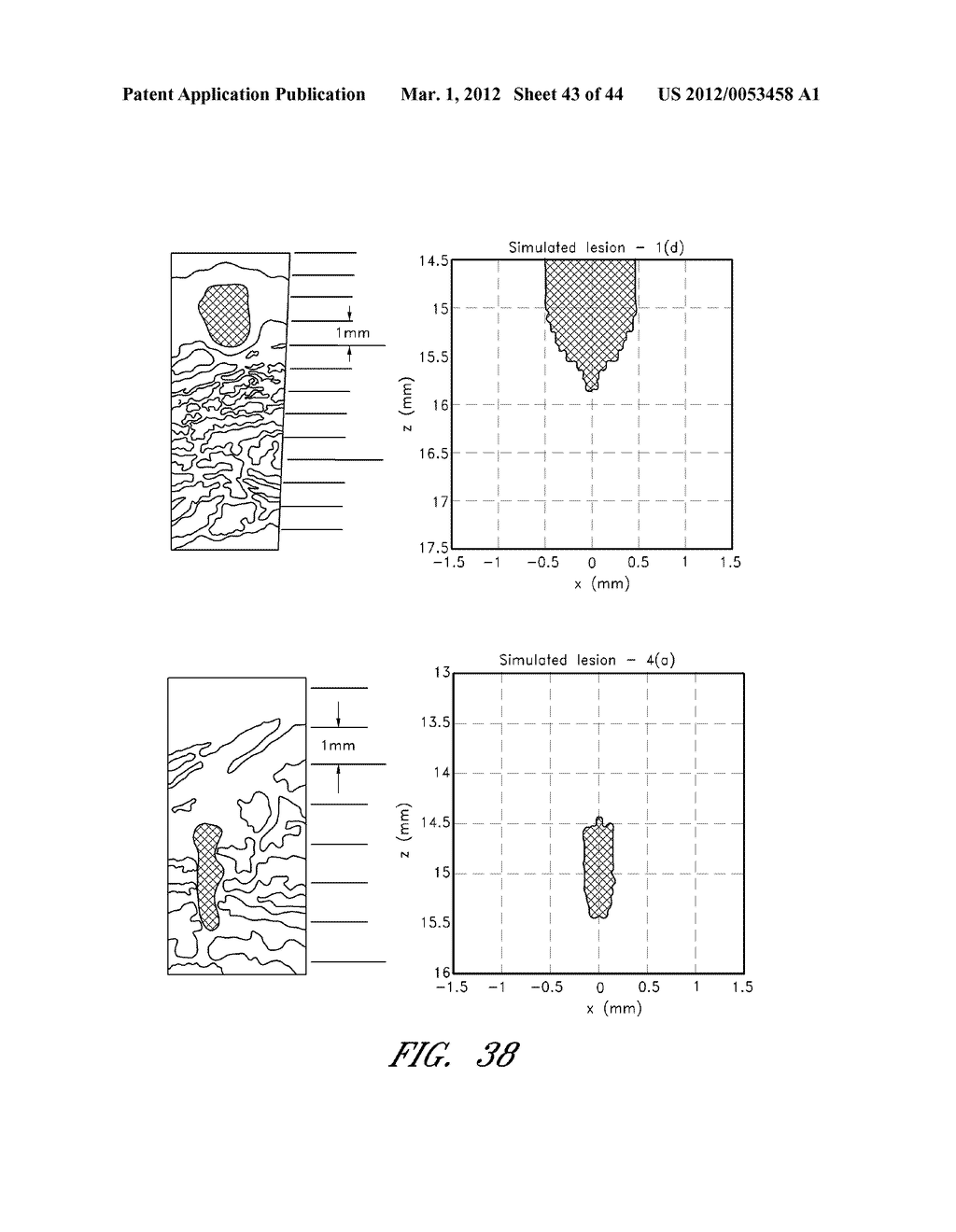 Methods For Non-Invasive Lifting And Tightening Of The Lower Face And Neck - diagram, schematic, and image 44