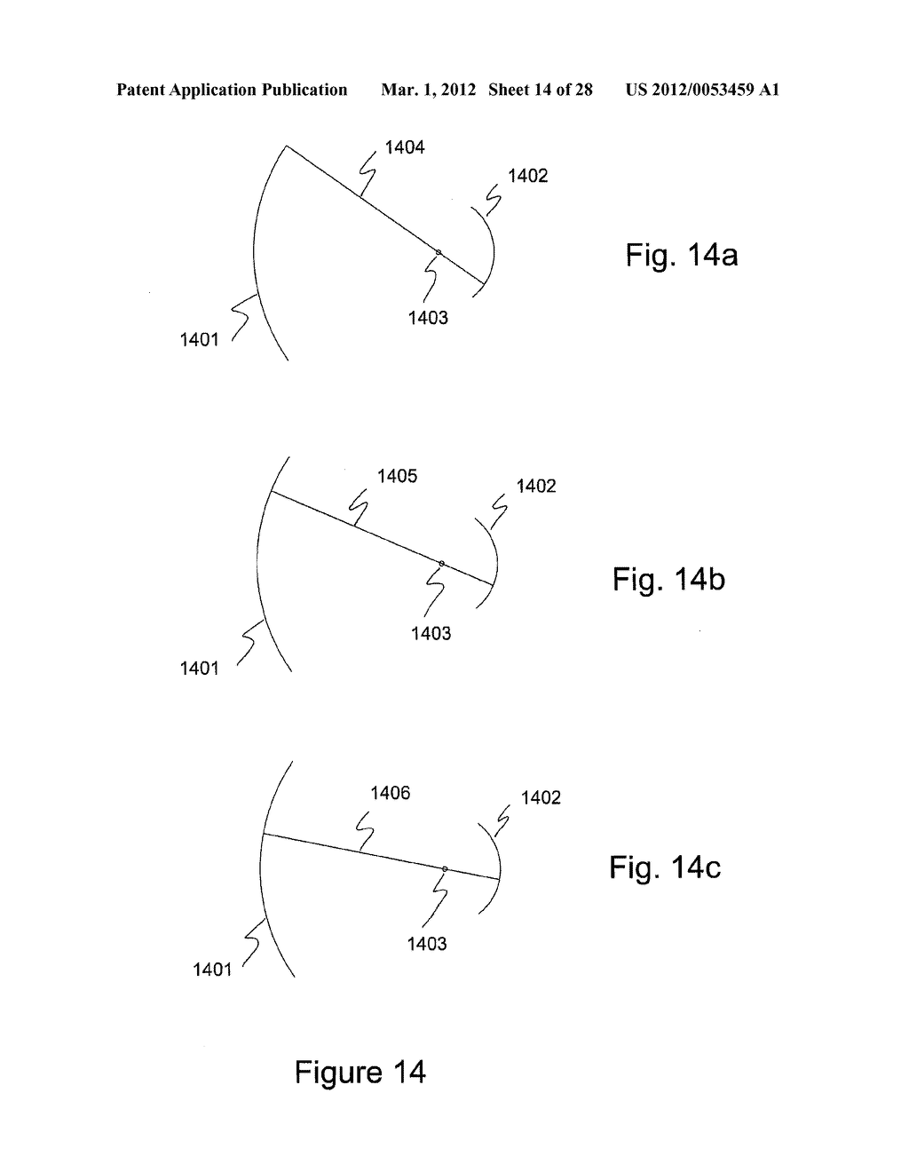 ALIGNMENT AND IMAGING OF AN EYE WITH AN ULTRASONIC SCANNER - diagram, schematic, and image 15