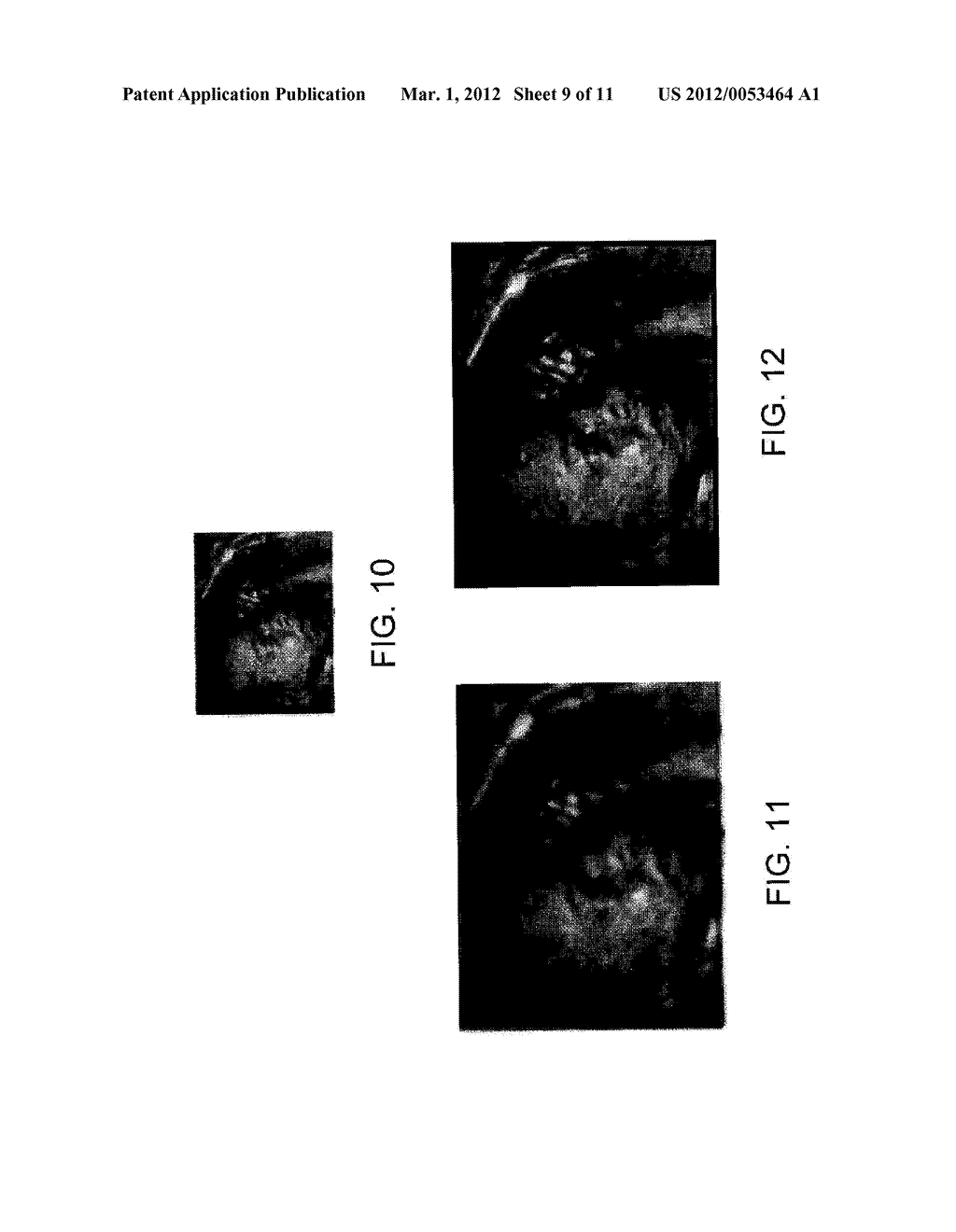 ULTRASONIC IMAGE PROCESSING APPARATUS - diagram, schematic, and image 10