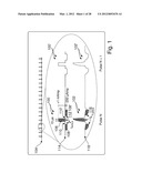 TISSUE CHARACTERIZATION USING INTRACARDIAC IMPEDANCES WITH AN IMPLANTABLE     LEAD SYSTEM diagram and image