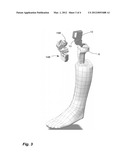 PROXIMITY-TRIGGERED COMPUTER-ASSISTED SURGERY SYSTEM AND METHOD diagram and image