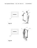 PROXIMITY-TRIGGERED COMPUTER-ASSISTED SURGERY SYSTEM AND METHOD diagram and image