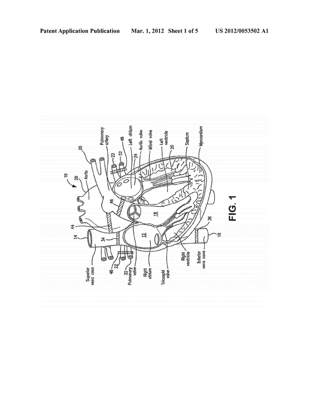 PERFUSION CIRCUIT AND USE THEREIN IN TARGETED DELIVERY OF MACROMOLECULES - diagram, schematic, and image 02