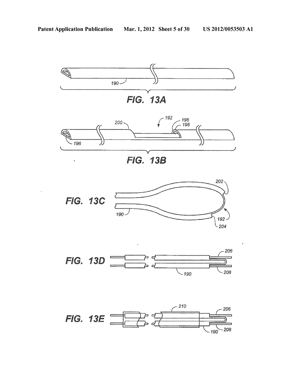 LOOP-TIP CATHETER - diagram, schematic, and image 06