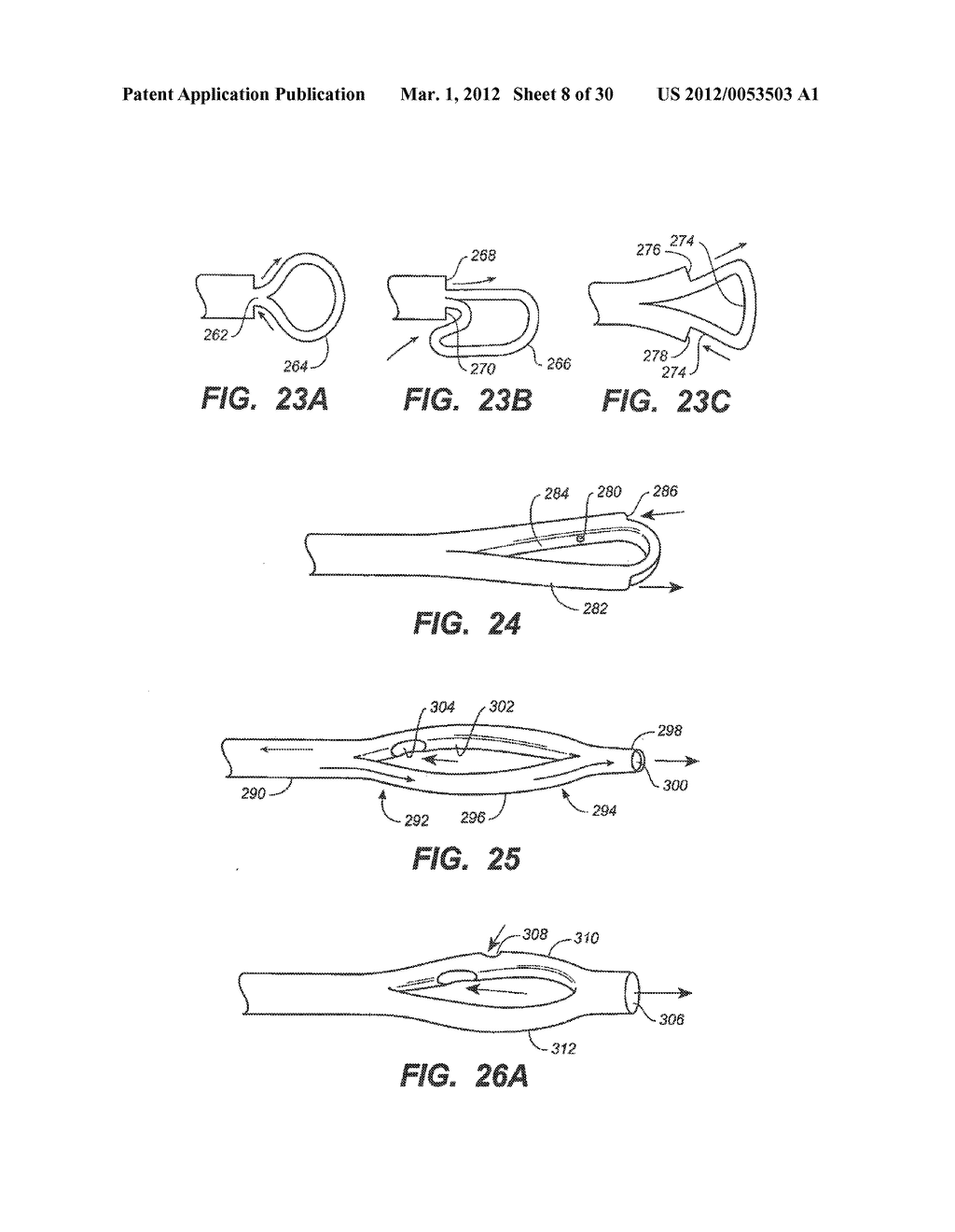 LOOP-TIP CATHETER - diagram, schematic, and image 09