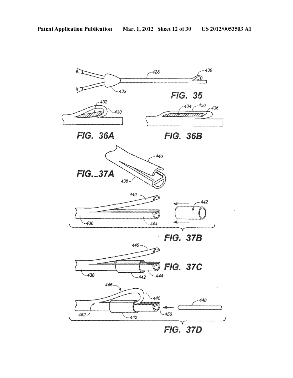 LOOP-TIP CATHETER - diagram, schematic, and image 13