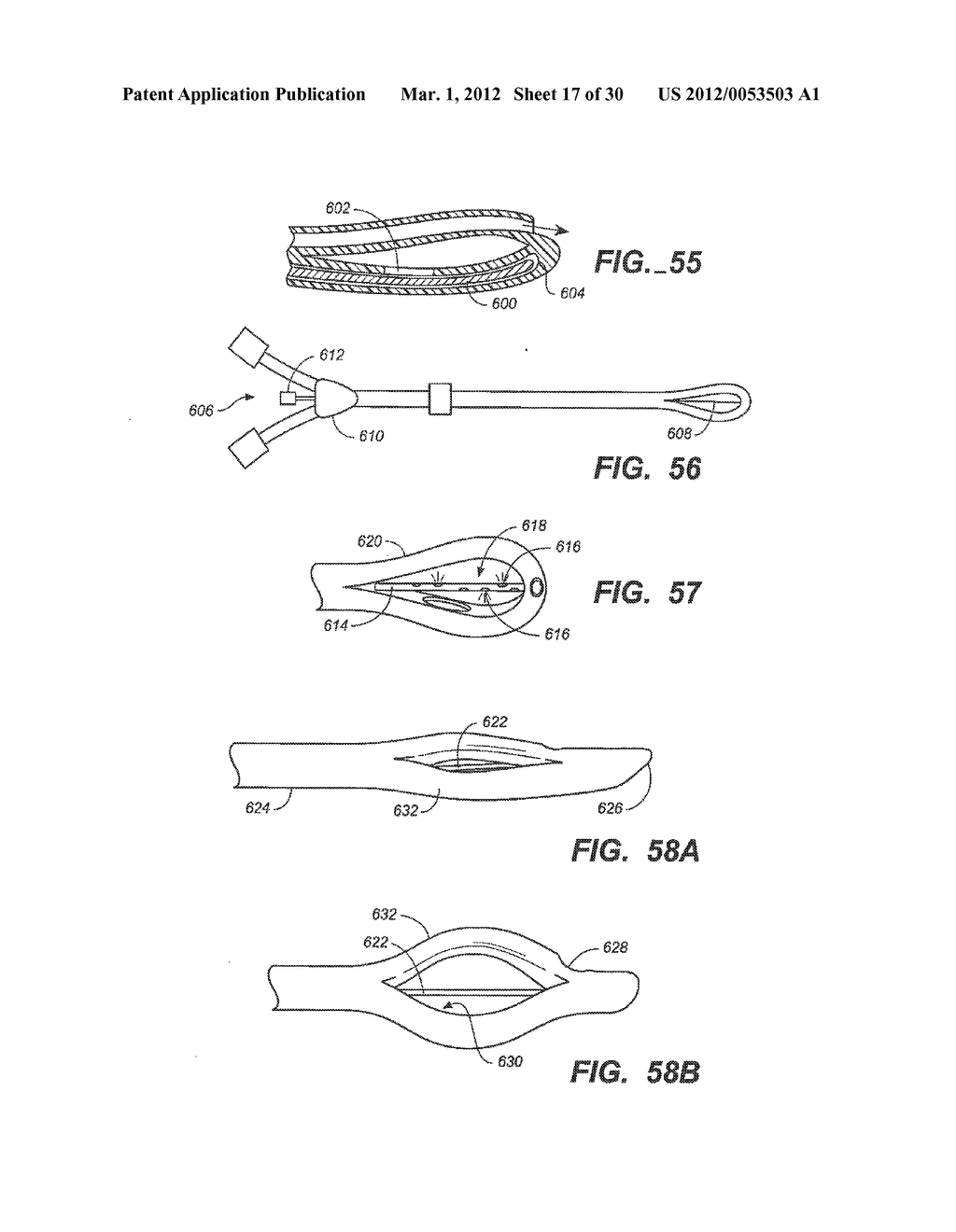 LOOP-TIP CATHETER - diagram, schematic, and image 18