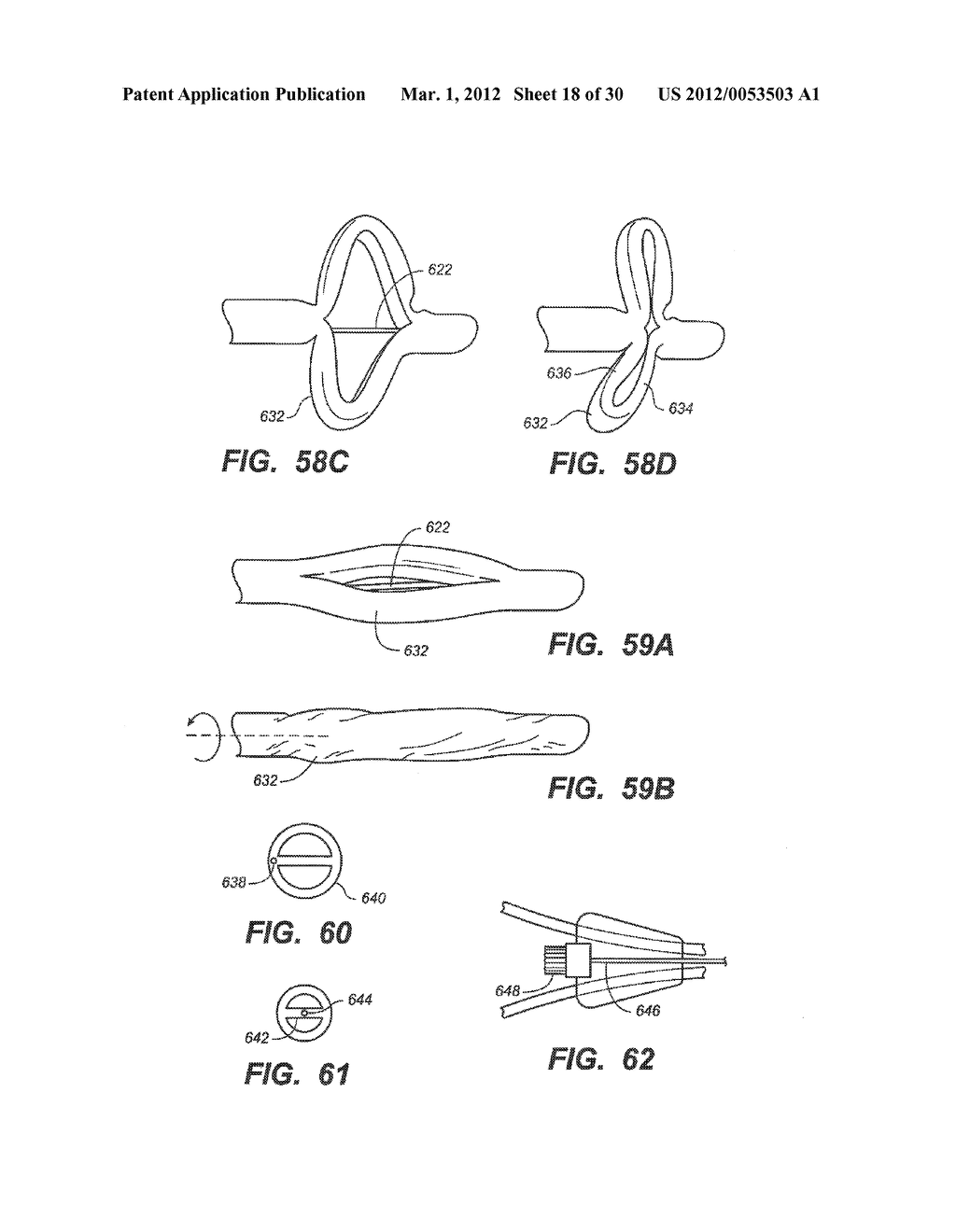 LOOP-TIP CATHETER - diagram, schematic, and image 19