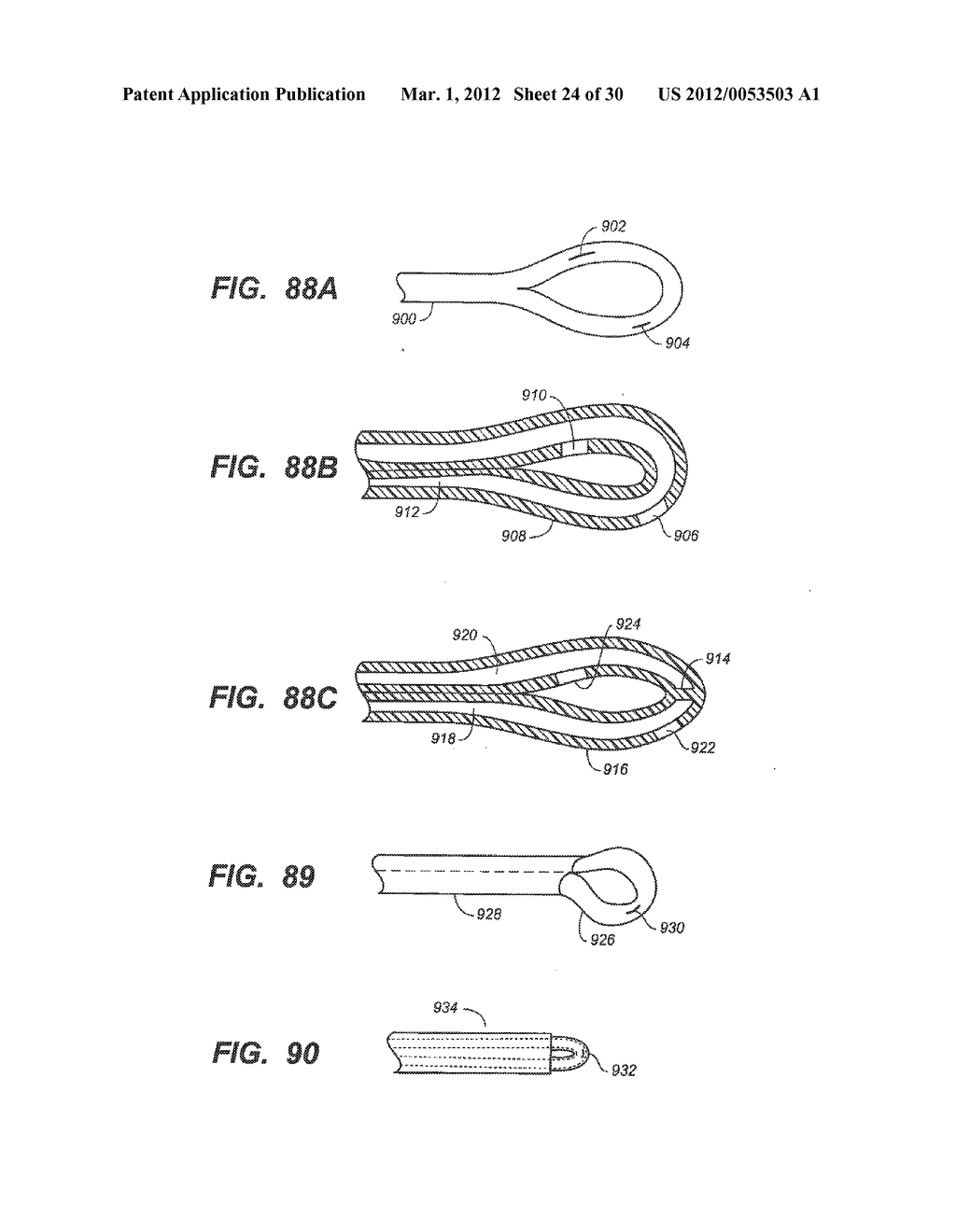 LOOP-TIP CATHETER - diagram, schematic, and image 25