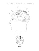 Apparatus and Method for Periodic Fluid-Delivery/Fluid-Removal Cycles in     the Cranial Subarchnoid Space to Treat Cerebral Cortical Disorders diagram and image