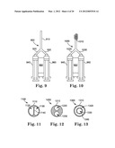 Treatment of Cardiac Arrhythmia by Modification of Neuronal Signaling     Through Fat Pads of the Heart diagram and image