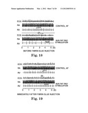 Treatment of Cardiac Arrhythmia by Modification of Neuronal Signaling     Through Fat Pads of the Heart diagram and image