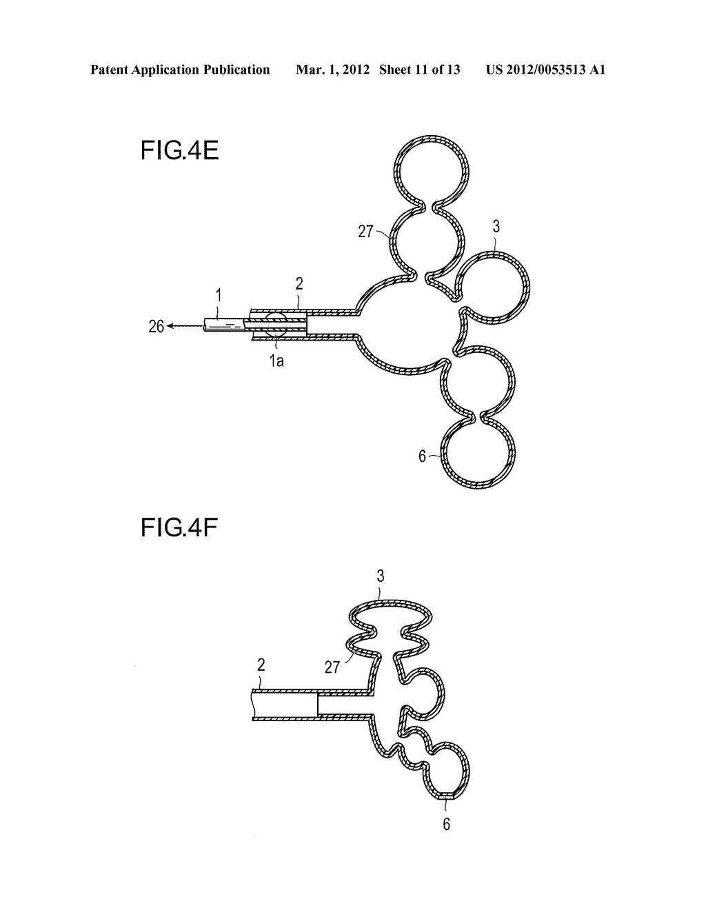 METHOD FOR TREATMENT OF EMPHYSEMA - diagram, schematic, and image 12