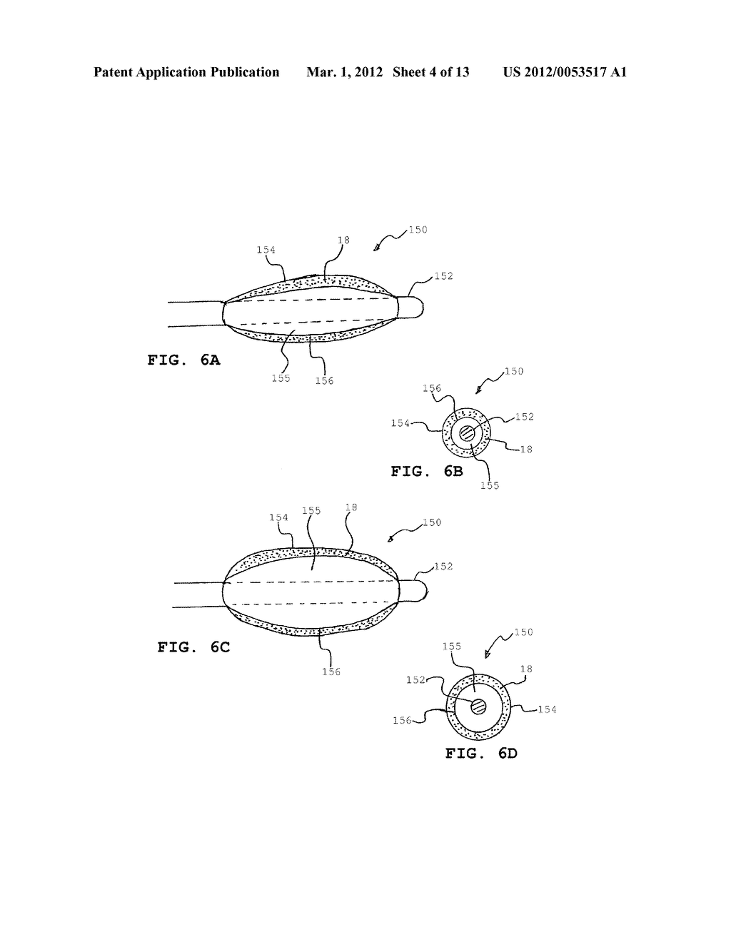 BALLOON CATHETER DEVICES WITH SHEATH COVERING - diagram, schematic, and image 05